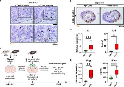 Novel T cell/organoid culture system allows ex vivo modeling of intestinal graft-versus-host disease